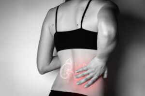 Urolitíase ou cálculo renal são termos utilizados para designar o que muitas pessoas conhecem como pedra nos rins. Leia o texto para entender mais sobre causas e sintomas de cálculo renal, bem como aliviar e tratar o problema. O que é cálculo renal? É um distúrbio provocado pela formação de substâncias minerais dentro dos rins, que é o órgão responsável pela eliminação de toxinas e dejetos do metabolismo do corpo por meio da urina. Esses cristais que se formam nos rins, costumam ser eliminados quando a pessoa produz urina suficiente, mas quando isso não ocorre, essas substâncias se juntam e formam uma pedra, que vai provocar uma dor intensa quando se desloca. O problema é bastante frequente e costuma atingir mais os homens, porém, as mulheres também estão sujeitas. Os cálculos renais podem ser classificados de acordo com a sua localização e composição. São 4 tipos de cálculos renais: Cálculo de cálcio: quando há uma grande presença de sais de cálcio e oxalato na urina. Representa 80% dos casos. Quando há muito cálcio é uma condição conhecida como hipercalciúria, já quando há muito oxalato é denominado hiperoxalúria; Cálculo de ácido úrico: formados em urina com pH baixo (ácido) e em condições que levem a hiperuricosúria, que seria o aumento do ácido úrico na urina; Cálculo de cistina: são cálculos mais raros que se formam a partir de uma grande quantidade de cistina na urina, que é um aminoácido. Podem se formar em pessoas que têm cistinúria; Cálculo de estruvita: indica uma infecção prévia, e são pedras compostas por uma mistura de amônia, fosfato e magnésio. São causados por bactérias (por exemplo, Proteus sp, Klebsiella sp). Ao contrário de outros tipos de cálculos, estes ocorrem com frequência 3 vezes maior em mulheres. Quanto à localização dos cálculos, podem estar dentro do rins, que é onde fica a maioria das pedras, porém, pode percorrer o trato urinário e seguir para os ureteres (que é o canal que leva urina do rim para a bexiga) ou para a bexiga. Cálculo renal: sintomas Muitas vezes, o cálculo se forma dentro do rim, mas fica parado, então o paciente será assintomático. Mas, quando essa formação se move e causa uma obstrução à drenagem de urina dos rins, leva à cólica renal, que é o sintoma mais evidente deste problema. A dor costuma ser muito intensa e aguda, com espasmos, irradiando para as costas e parte inferior do abdômen, e surge repentinamente, porém, há outros sinais que acusam o problema: Dificuldade de urinar ou pequena quantidade de urina, mesmo com muita vontade; Ardência ao urinar; Presença de sangue na urina; Náuseas e vômitos; Infecção urinária; Febre. Cálculo renal: causas Em geral, o que causa o cálculo renal é o desequilíbrio hídrico no organismo, porque a quantidade de líquido não é suficiente para dissolver os sais, que irão se tornar cristais na urina e formar as pedras. Por isso, pacientes que costumam desenvolver esses cálculos ingerem poucos líquidos. Porém, alguns outros pacientes, mesmo tomando líquidos na quantidade adequada, ainda ficam sujeitos à formação dos cálculos no rins, devido a fatores de risco como: Genética; Distúrbios metabólicos; Fatores ambientais (locais muito quentes); Alimentação inadequada; Alterações anatômicas; Obesidade; Diabetes; Ganho acentuado e rápido de peso; Hipertensão; Uso de certas medicações. Cálculo renal: tratamento e alívio Quando a dor começa, não há o que alivie, nem repouso, nem movimento, não há nenhuma posição adequada. Em geral, a crise pode durar por horas, com ápice de dor em 2 horas, seguidas por vômitos, e só vai aliviar com o atendimento médico. Por isso, quando a dor nos rins é muito intensa, provocando náuseas e vômitos, a melhor saída para aliviar a crise é buscar ajuda em um pronto-atendimento. Além de colocar o paciente para receber soro fisiológico, o que poderá ajudar na recuperação da desidratação provocada pelos possíveis vômitos, os médicos também podem prescrever um remédio para cálculo renal, como as medicações via venosa de analgésicos, anti-inflamatórios e antiespasmódicos. Além disso, o médico também pode investigar se o cálculo provocou uma infecção urinária e até hidronefrose (obstrução da urina), por meio de exames de urina, sangue e exames de imagem. Quando o cálculo é pequeno, poderá ser expelido naturalmente, para isso, será indicada uma maior ingestão de líquidos para ajudar na eliminação. Porém, se a pedra for maior que 0,5 cm pode indicar a necessidade de uma cirurgia para cálculo renal, especialmente se tiver causado hidronefrose, com risco de consequências graves caso não seja tratada com rapidez, como pielonefrite e insuficiência renal. Uma das intervenções cirúrgicas é a ureterorrenolitotripsia, que é um procedimento minimamente invasivo, mas há outros tipos de cirurgia, inclusive, com o método tradicional. Como evitar cálculo renal? Uma das formas de prevenir a formação de cálculos renais é manter um constante equilíbrio hídrico no organismo, ingerindo, no mínimo, 1,5 a 2 litros de líquidos por dia. Outro ponto importante é que o paciente deve evitar o consumo de alimentos que contêm oxalato, como refrigerantes, café e até alguns tipos de chá (mate, verde e preto). Além de evitar também consumir muita proteína e excesso de sal. Outro aspecto é que os estudos médicos também apontam que o excesso de vitamina C no organismo pode levar à formação de cálculos. No entanto, não é necessário reduzir o consumo de alimentos ricos em cálcio, que também são essenciais para o organismo, mas fique atento à ingestão de suplementos de cálcio. Nestes casos, há sim o risco de desenvolvimento de pedras nos rins. Para avaliar se corre risco de uma crise renal, o paciente também deve ficar atento à cor da sua urina, quanto mais clara, melhor. O odor também não deve ser intenso. Se a urina estiver escura e com cheiro forte, pode ser o indício de desidratação, o que aumenta o risco de formação de cálculos renais. Quando as pessoas têm uma predisposição ao problema, precisam manter esses cuidados constantemente, porque, em geral, quando um paciente já teve cálculos renais há uma chance de 40% de desenvolver outra crise em 5 anos. Portanto, se já teve uma crise renal ou percebeu as características citadas acima na urina, é importante passar com um urologista, para fazer o devido acompanhamento e evitar as crises intensamente dolorosas. O médico poderá fazer um planejamento terapêutico que vai evitar todo esse desconforto.