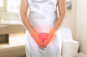Inflamações, escapes, vontade frequente de urinar e dores crônicas são alguns problemas da bexiga que geram muito desconforto nas mulheres. Veja nesse texto quais são as principais patologias que incomodam o público feminino, os sinais de problemas na bexiga e como tratar. Como saber se estou com problema na bexiga? Essa é uma pergunta que muitas mulheres fazem a si mesmas antes de passar por uma consulta com um médico. O motivo é porque são diversos os problemas na bexiga que podem afetar a qualidade de vida da população feminina. Embora esse órgão oco, responsável pelo armazenamento da urina e que fica na parte inferior da pelve, seja igual nos homens e nas mulheres, em muitos casos, as condições anatômicas das mulheres favorecem que as patologias urinárias acometam muito mais elas do que eles, porque a uretra feminina é mais curta, mede cerca de 4 cm e o esfíncter (músculo responsável pela continência) tem aproximadamente de 2,5 cm. Mas são os diversos sintomas de problemas na bexiga que podem indicar que a hora é de buscar um especialista, inclusive para proteger o aparelho urinário superior de doenças que podem ser até fatais. Vamos conhecer esses problemas na bexiga, sintomas, causas e como tratar. Cistite Conhecida como infecção urinária ou inflamação da bexiga, a cistite é uma doença do trato urinário que afeta muito as mulheres, especialmente devido às questões anatômicas femininas. Cerca de 60% das mulheres terão esse problema no trato urinário em algum momento da vida. No entanto, homens também podem ter esse problema na bexiga. É uma doença provocada pela ação de micro-organismos (fungos ou bactérias), que ficam na região perineal, mas conseguem atingir a bexiga e desencadear um processo inflamatório. Os sintomas desse problema na bexiga feminina são vontade de urinar frequente, dor na bexiga, ardência ao urinar, micção com pouca quantidade, dores no baixo ventre, sangue na urina, urina turva e com cheiro forte, além de febre baixa. Após detectar a infecção com exames de urina, o tratamento, em geral, é realizado com ingestão de antibióticos ou antifúngicos. A cistite não tratada pode levar à infecção do trato urinário superior, atingindo os rins com uma patologia conhecida como pielonefrite, que pode colocar a paciente em risco de lesionar o órgão e até ser fatal. Ingerir mais líquidos, ter higiene íntima adequada, ir mais frequentemente ao banheiro para urinar, esvaziando completamente a bexiga; e adotar hábitos saudáveis, para melhorar o sistema imunológico, são medidas para evitar a cistite. Cistite intersticial (Síndrome da Bexiga Dolorosa) Os estudos médicos também revelam que 90% do público atingido pela doença é feminino. A idade mais acometida é acima dos 40 anos. A cistite intersticial não se trata da mesma patologia que a cistite tradicional, pode ser conhecida também como síndrome da bexiga dolorosa e provocar lesão e espessamento da parede vesical. É uma inflamação crônica não infecciosa, que pode ser confundida com a infecção urinária recorrente. Em geral, a cistite intersticial é causada por doenças autoimunes, mas também por agressão da bexiga por substâncias tóxicas e defeito na permeabilidade da parede da bexiga. Entre os sintomas desse problema na bexiga, ocorrem urgência miccional, aumento da frequência urinária, noctúria, sensação de pressão e sensibilidade na bexiga, dor no ato sexual e dor no baixo ventre. Os sintomas costumam piorar durante a menstruação. O tratamento pode ser o uso de analgésicos, antidepressivos, anti-histamínicos, botox ou outras abordagens cirúrgicas. Bexiga Hiperativa A bexiga hiperativa pode afetar as mulheres, especialmente, após a menopausa. Esse problema na bexiga feminina é causado pelo mau funcionamento do órgão, que vai sofrer uma redução em sua capacidade de armazenamento da urina. Devido a essa disfunção no trato urinário surge uma necessidade urgente de urinar (mais de 8 vezes ao dia), que fica muito difícil de ser controlada. Assim, a doença também está associada à incontinência urinária. Essa doença pode provocar um verdadeiro isolamento social, já que a pessoa sabe que pode não conseguir controlar a micção e sofrer com escapes urinários, ocasionando situações de muito constrangimento. Assim, há reflexos na autoestima e na qualidade de vida, porque o sono também fica muito prejudicado. Após solicitar um diário miccional do paciente e descartar infecções urinárias, tumor de bexiga, diabetes ou formação de pedras na bexiga, o médico pode iniciar o tratamento da bexiga hiperativa com fisioterapia e terapia comportamental. A abordagem terapêutica envolve mudança de dieta, perda de peso, micções programadas, parar de fumar, etc. Além disso, também podem ser prescritos remédios e aplicação de botox para o tratamento do problema. Incontinência urinária A incontinência urinária é caracterizada por qualquer perda de urina, independentemente da quantidade. Esse problema na bexiga também é mais comum nas mulheres, atinge 45% delas, especialmente com o avançar da idade. No entanto, pode ocorrer também problemas na bexiga após cesárea ou após uma episiotomia para o parto, que vão ocasionar a incontinência. Em geral, o problema está dividido em duas categorias: incontinência de esforço e incontinência de urgência. A incontinência também traz os mesmos problemas emocionais da bexiga hiperativa e precisa ser tratada. O problema pode ser tratado com fisioterapia, terapia comportamental, medicamentos e até cirurgia, vai depender de cada caso. Bexiga caída Uma condição que pode afetar até 20% das mulheres no mundo inteiro é a bexiga caída. Esse problema na bexiga também é conhecido como prolapso vaginal ou cistocele. Nesta situação, o órgão começa a descer pela cavidade vaginal, chegando, no estágio mais avançado, a se projetar para fora do corpo. É uma questão muito delicada para uma mulher. Entre os principais sintomas desse problema na bexiga estão dificuldades para esvaziar a barriga completamente, urgência urinária, frequência de micção aumentada, dor na bexiga, sensação de bola na vcagina, dor no sexo, peso na região pélvica e infecções urinárias constantes. Essa condição ocorre devido a uma fragilidade na musculatura pélvica feminina, e os principais fatores que podem desencadear o problema são: envelhecimento, número de gestações vaginais e instrumentais, tosses crônicas, constipação intestinal, menopausa, obesidade e atividades físicas extremas. O tratamento será de acordo com o estágio em que se encontra o prolapso, vai desde observação e acompanhamento do avanço, uso de pessários, fisioterapia preventiva e cirurgias. Se você tem problemas na bexiga, que médico procurar? O especialista que cuida das questões do trato urinário das mulheres é o urologista, dentro da subespecialidade urologia feminina. Além disso, relatados aqui os principais sintomas, fica mais fácil identificar que há uma patologia que merece atenção e buscar ajuda profissional. Qual exame detecta problemas na bexiga? Em geral, exames laboratoriais, como testes urodinâmicos, ajudam o especialista a fazer a investigação do problema na bexiga, mas um exame que ajuda muito no diagnóstico da patologia vesical é a cistoscopia. Esse exame, que visualiza a bexiga e a uretra, pode detectar diversas questões, como inflamações no órgão, câncer ou cálculos urinários. Com os resultados dos exames, o urologista vai indicar a melhor abordagem terapêutica. Portanto, não demore para buscar um especialista, quanto antes for descoberto o problema da bexiga, mais cedo a paciente retoma sua qualidade de vida.