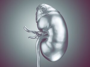 A ureterocele é uma condição urológica que afeta mais as meninas e pode trazer consequências graves ao organismo. Leia neste texto mais sobre suas causas, sintomas e formas de tratamento deste problema. O que é ureterocele? A ureterocele é uma anomalia congênita que causa um inchaço limitado ao final do ureter no ponto em que entra na bexiga. Semelhante a um balão, essa condição pode interromper o fluxo de urina para a bexiga e trazer sérias consequências. A causa desse problema é uma malformação que ocorre ainda dentro do útero materno. Em condições normais, os rins filtram e removem resíduos e o excesso de água do sangue, produzindo a urina. Para seguir dos rins à bexiga, a urina percorre os ureteres (cada rim possui um ureter), então sai do corpo pela uretra. Mais frequentemente, costuma ser diagnosticada a ureterocele em bebê, porém, também pode ser diagnosticada em crianças maiores ou apenas na fase adulta. Pode ocorrer a ureterocele à direita ou esquerda, acometendo apenas um ureter ou de ambos os lados (ureterocele bilateral). Nas meninas, em geral, a condição está presente em ambos. O inchaço apresentado pode ser pequeno ou mesmo ocupar uma boa parte da bexiga, que é outra condição inadequada do sistema urinário, quando a urina flui incorretamente de volta aos rins. A ureterocele é potencialmente grave, porque predispõe os pacientes à formação de cálculos renais, retenção urinária, infecções urinárias recorrentes e infecções renais, que podem ocasionar danos graves aos rins e até insuficiência renal. Outra complicação importante é o risco de septicemia, devido ao bloqueio constante dos ureteres. Quais são os sintomas de ureterocele? A condição em si pode não gerar sintomas, mas quando surgem as infecções no trato urinário os pacientes podem sentir: Dor e ardência ao urinar; Urina com cheiro fétido; Aumento da frequência miccional; Não conseguir esvaziar a bexiga completamente; Febre. Como diagnosticar a ureterocele? É muito importante diagnosticar essa disfunção do trato urinário o quanto antes. Quando não detectada na infância, o que é mais comum, o médico pode desconfiar da ureterocele em idosos ou adultos quando há um quadro recorrente de infecções urinárias. Então o especialista vai solicitar exames. Um dos primeiros é o exame laboratorial de urina, que vai revelar se há uma infecção urinária. Para diagnosticar a ureterocele, o ultrassom é um exame muito eficaz porque já consegue apresentar o ureter e rim inchados durante o procedimento. No entanto, algumas ureteroceles podem não ser visualizados em uma ultrassonografia, assim outros exames que podem ser indicados são a tomografia computadorizada e a ressonância magnética para avaliar melhor rins e bexiga. Outra alternativa é solicitar uma cistouretrografia miccional, que analisa anormalidades da bexiga e uretra, checando se há refluxos ureterais,e o tamanho e localização da ureterocele. Leia mais sobre: Incontinência urinária Como tratar a ureterocele? O tratamento dessa condição vai depender da idade e da saúde do paciente, se o rim foi ou não afetado e se há ou não presença de dilatação do ureter e pelve renal. Uma alternativa de tratamento complementar é fazer um pequeno procedimento, conhecido como punção transuretral, para corrigir essa condição logo após o nascimento do bebê. Já o tratamento para ureterocele em adulto pode envolver a realização de uma cirurgia de reconstrução do trato urinário. Mas o médico irá avaliar caso a caso. No caso da indicação de uma cirurgia, o médico analisa as abordagens e técnicas mais apropriadas quando for uma ureterocele unilateral e bilateral. Atualmente, em geral, as cirurgias para tratar essa condição são minimamente invasivas, realizadas de forma endoscópica e abertura endoscópica da ureterocele. Raros casos podem necessitar de reimplante do ureter na bexiga. Essa abordagem previne o refluxo urinário e também preserva a função renal. São procedimentos que podem demorar cerca de 1 hora. O pós-operatório de cirurgia de ureterocele com método minimamente invasivo é bem mais simples do que uma cirurgia aberta. Conclusão É preciso ficar sempre atento à saúde do sistema urinário, para não correr riscos de agravamento do quadro. Se alguém tem infecções urinárias frequentes, pode ser um caso de ureterocele que não foi tratado na infância. Portanto, buscar um especialista será fundamental, porque o médico poderá avaliar todos os sintomas, pedir os exames apropriados e fazer o melhor planejamento terapêutico para tratar essa condição.