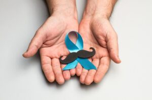 No Brasil, o câncer de próstata é um dos mais incidentes na população masculina, perdendo apenas para o câncer não-melanoma. É também uma importante causa de mortalidade entre os homens. Em 2020, 65.840 foram diagnosticados com a doença no país. Esse câncer é silencioso, e só manifesta sintomas quando está em um estágio bastante avançado. Portanto, é muito importante que os homens comecem a frequentar o urologista a partir dos 40 anos, para acompanhar a saúde da próstata. Veja nesse texto o que é câncer de próstata, sintomas, causas, tratamentos (como a cirurgia robótica), e o que fazer se surgir uma incontinência urinária após algum tratamento. O que é o câncer de próstata? O câncer de próstata ocorre quando as células dentro da glândula começam a crescer descontroladamente. A próstata é uma glândula própria do sistema reprodutor masculino. Fica no colo da bexiga e na frente do reto. A uretra passa pelo centro desta glândula. Sua função é produzir um fluido que se mistura e enriquece o sêmen, para melhorar a fertilidade. A partir dos 40 anos, pode sofrer com algumas patologias, como a hiperplasia prostática benigna e o câncer. Não estão bem definidas quais são as causas que levam um homem a desenvolver o câncer de próstata, porém, já se sabe de alguns fatores de risco que podem explicar a doença em um organismo: Hereditariedade; Envelhecimento; Raça (negros têm maior predisposição); Obesidade. A maioria dos cânceres nesta glândula são adenocarcinomas, ou seja, derivado das células glandulares epiteliais excretoras. Os outros tipos são: carcinomas de pequenas células ou de células transicionais, sarcomas e tumores neuroendócrinos. Quais os sintomas de câncer de próstata? Os sintomas do câncer de próstata demoram para surgir e começam a se manifestar quando o problema já está adiantado. São: Sangue na urina e no sêmen; Aumento da frequência urinária; Urgência urinária; Problemas para urinar (dificuldade para começar e jato urinário fraco); Dor nos ossos (quadris, coluna e costelas); Perda de peso; Fraqueza ou dormência nos pés; Disfunção erétil. Alguns desses sintomas são semelhantes aos da hiperplasia prostática (aumento da próstata), porém, é preciso exames para ter um diagnóstico mais preciso. Diagnóstico do câncer de próstata Durante uma consulta, o urologista irá fazer uma anamnese bem aprofundada, para investigar histórico familiar e sintomas (caso já manifesta). Um dos exames principais para o diagnóstico é o toque retal, além do exame PSA, que avalia a quantidade do antígeno específico da próstata no sangue. Quando os marcadores estão altos, pode ser um sinal da existência do câncer. No entanto, para refinar o diagnóstico, pode ser solicitada uma ultrassonografia transretal ou transperineal e uma biópsia. A detecção precoce do câncer de próstata é muito importante para possibilitar mais chances de o tratamento ser bem-sucedido. Em muitos casos nos quais a doença ainda está em estágios iniciais, pode não ser necessária a cirurgia, apenas a observação vigilante. É tão grande a necessidade de que os homens cuidem da própria saúde e façam consultas periódicas ao urologista, especialmente após os 45 anos, que surgiu a campanha Novembro Azul, que acontece em várias partes do mundo para estimular a detecção precoce do câncer de próstata. A campanha é realizada por diversas entidades e dirigida especificamente aos homens. Tratamentos do câncer de próstata É muito importante buscar tratamento para essa patologia, porque o câncer de próstata pode espalhar por outros órgãos, o que é chamado metástase, e levar à morte. Pode tanto se espalhar para órgãos próximos, como a bexiga, como para os ossos e até a corrente sanguínea. Além disso, o câncer de próstata ou o seu tratamento pode deflagrar uma disfunção erétil. Outra complicação importante que ocorre com certos tipos de tratamento é a incontinência urinária. O tratamento do câncer de próstata vai depender de diversos fatores. Entre eles, estão incluídas a terapia hormonal, imunoterapia, quimioterapia, radioterapia, terapia medicamentosa direcionada ou a cirurgia de próstata robótica, laparoscópica ou aberta para retirada total da glândula, o que é conhecido como prostatectomia radical. No entanto, em geral, a prostatectomia aberta é o principal motivo de surgimento da incontinência urinária ou disfunção erétil em homens que estão tratando o câncer. O primeiro motivo é porque a técnica aberta pode lesionar os nervos responsáveis pela ereção e micção. Mas as prostatectomias robóticas diminuem os riscos de incontinência urinária e disfunção erétil, sangramentos, infecções e tem um restabelecimento mais rápido. O segundo motivo para o desenvolvimento da incontinência urinária tem a ver com a radiação emitida no tratamento. Vamos ver mais detalhes abaixo. Leia mais sobre: RTU de próstata Incontinência é efeito colateral da cirurgia aberta de próstata Quando os homens estão com câncer de próstata, as cirurgias prostáticas podem levar alguns deles ao desenvolvimento da incontinência urinária. Em geral, a incontinência urinária é um problema que aflige muito mais as mulheres, especialmente a partir do envelhecimento, mas nos homens, em boa parte dos casos, tem a ver com a cirurgia para tratamento do câncer de próstata. Quando um homem que está com câncer de próstata faz uma prostatectomia radical para a retirada total da glândula e dos tecidos que a rodeiam, que incluem vesículas seminais e alguns gânglios linfáticos, ou mesmo se submetem à radioterapia, que é necessária após remoção de alguns tipos de câncer, uma das possíveis consequências é a incontinência urinária, que é um problema urológico caracterizado pela incapacidade de controlar a micção. Cerca de 2% a 10% dos pacientes que fazem a cirurgia ou a radioterapia para câncer de próstata podem ficar com esse efeito colateral. Esse é um dado muito relevante porque a incontinência urinária traz sérios impactos para a qualidade de vida de uma pessoa. Em primeiro lugar, os homens já ficam abalados com a existência do câncer em si, e ao fazer a cirurgia ou radiação, e perceberem que estão incontinentes, podem surgir alguns problemas emocionais, sem contar os prejuízos que isso pode causar para a vida social e até o trabalho. Leia mais sobre: Bexiga hiperativa Dor na bexiga Por que tratamentos para câncer de próstata levam à incontinência? A incontinência após uma prostatectomia pode ocorrer em função da lesão provocada no esfíncter (músculo responsável pela continência) ou em nervos que ajudam a controlar o funcionamento da bexiga, que acontece durante a cirurgia quando o câncer está mais aprofundado nos tecidos. Já a radiação também pode diminuir a capacidade de reter a urina, causar espasmos e resultar em escapes urinários. Mas, estudos sobre a cirurgia robótica para tratamento do câncer de próstata mostram que a incontinência temporária, que pode ocorrer após o procedimento, tende a ter uma recuperação mais rápida, ou seja, um retorno mais precoce da continência, quando comparada à técnica convencional. No entanto, mesmo para aqueles que continuarem com o problema muito tempo após a cirurgia dos muitos tipos de câncer de próstata, há tratamentos para que essa condição seja normalizada. Como tratar a incontinência após o câncer de próstata? O primeiro passo será buscar um urologista que vai avaliar o tipo de incontinência urinária e estágio do problema, porque o grau varia de pessoa para pessoa, alguns homens podem perceber que perdem urina por gotejamento, enquanto outros perdem grandes volumes. Normalmente, após o tratamento para câncer de próstata, os tipos mais comuns são a incontinência por esforço e urgência. No primeiro caso, a perda urinária ocorre em situações onde ocorra uma pressão maior sobre a bexiga, como uma gargalhada intensa, um espirro ou a prática de um exercício físico. Já a incontinência de urgência é mais comum nos pacientes que são tratados com radioterapia, pois passam a ter espasmos e algumas contrações involuntárias que tornam urgente a vontade de urinar. O tratamento da incontinência urinária para esses casos pode ter inúmeras abordagens, como a terapia comportamental e as cirurgias. A fisioterapia e abordagem comportamental são consideradas a primeira linha para o tratamento da incontinência. Na fisioterapia estão previstos a realização de exercícios de Kegel e estimulação elétrica para fortalecimento do assoalho pélvico. Já na terapia comportamental, os pacientes são orientados ao controle da ingestão de líquidos, buscar evitar correr ao banheiro sempre que surgir a vontade de urinar, programar horários para urinar, etc. Para casos mais moderados também podem ser tentados métodos como as injeções endoscópicas. Cirurgias para incontinência urinária nos homens Há também cirurgias para o tratamento da incontinência urinária nos homens após uma prostatectomia. As mais indicadas são o esfíncter artificial e sling: Esfíncter artificial Essa opção tem sido bastante indicada para homens que sofrem perdas de grandes volumes de urina ou de forma muito contínua. Essa solução já é considerada o padrão ouro para incontinência. O esfíncter artificial é um dispositivo com um balão que vai ocluir a uretra. Sling A colocação do sling uretral é um método minimamente invasivo, mais indicado para incontinência leve e moderada. Consiste em introduzir uma fita sintética ou biológica abaixo da uretra, que reforça a sustentação da estrutura urinária, com o objetivo de reduzir a perda de urina. Como prevenir o câncer de próstata? Mas, antes que um homem precise falar de tratamento da incontinência após uma intercorrência cirúrgica é preciso também buscar a prevenção do câncer de próstata ou mesmo o agravamento desta patologia. A hereditariedade e a idade são fatores de risco para o surgimento do câncer de próstata, portanto, mais uma vez vamos ressaltar que é muito importante que os homens passem a frequentar os consultórios dos urologistas a partir dos 40 anos, para fazer os exames clínicos, laboratoriais e endoscópicos, que são preventivos e necessários. Além disso, o risco dessa doença também aumenta com o excesso de gordura corporal. Assim, manter hábitos saudáveis, como a prática de exercícios físicos e uma alimentação balanceada, para manter o peso ideal, são fatores de prevenção. E mais um conselho importante: pare de fumar, porque esse também é um grande fator de risco para a doença. A principal mensagem desse texto é: homens, cuidem-se!