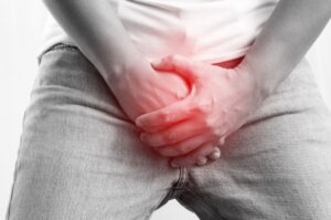 A estenose uretral é uma condição que pode ser confundida com várias patologias urológicas e traz muitos sintomas desconfortáveis. Para saber mais sobre o que é, o que causa, sintomas e tratamento desse quadro urológico, leia esse texto até o final. O que é estenose uretral? A principal função da uretra é transportar e eliminar a urina, nos homens também é o tubo pelo qual o sêmen sai pelo meato uretral. Em condições normais, esse canal é largo o suficiente para escoar os líquidos, mas, quando há um estreitamento que pode restringir o fluxo urinário, é definido como estenose uretral. Esse problema urológico pode ocorrer com homens e mulheres, porém, a estenose uretral feminina é muito mais rara. Já os homens ficam mais sujeitos ao problema devido ao fato de terem uma uretra mais longa. Esse estreitamento pode ocorrer em qualquer parte da uretra, atingir alguns milímetros ou envolver toda a extensão do órgão. Segundo dados da Sociedade Brasileira de Urologia, para cada 1.000 pessoas, 9 são acometidas. O que causa estenose uretral? Em geral, esse estreitamento ocorre devido a uma inflamação, lesão ou presença de tecido cicatricial. Inúmeros fatores podem levar a essa condição, como: Cirurgia prévia de hipospádia; Outros procedimentos cirúrgicos que envolvem introdução de instrumentos no canal; Uso constante de cateteres; Implantes penianos; Cirurgias na próstata; Hiperplasia prostática benigna; Infecções urinárias; Tumores; Traumas ou lesões na pelve ou uretra; Doenças sexualmente transmissíveis. Estenose de uretra: sintomas A estenose uretral causa dores na região pélvica ou abdominal, mas também pode trazer outros desconfortos crescentes relacionados a um sistema urinário enfraquecido, como: Vontade frequente e repentina de urinar; Esvaziamento incompleto da urina; Ardência e dor durante a micção; Incontinência urinária; Inchaço e dor no pênis; Sangue no sêmen; Fluxo de urina fraco; Urina escurecida; Incapacidade de urinar, etc. Todos esses sintomas são bastante desconfortáveis, mas a incapacidade de micção é o mais grave, é conhecido como retenção urinária, que pode levar a quadros perigosos para a função renal. Por isso, quando alguém percebe esses sinais deve buscar um especialista o mais rápido possível para saber se está com estenose de uretra e providenciar o tratamento. Leia mais sobre: Bexiga hiperativa Dor na bexiga Como é realizado o diagnóstico? Quando existe a desconfiança do médico que um paciente tem estenose da uretra a partir de suas queixas, ele pode realizar teste físico e solicitar pedidos de exame de imagem que vão permitir observar as condições da uretra, como um ultrassom, ou uma uretroscopia, para ver o interior do canal. Em geral, testes não invasivos não conseguem detectar se o volume residual de urina na bexiga é fruto de uma estenose. Porém, no exame de uretroscopia é possível observar a uretra. Nesse exame, será introduzido um instrumento de visualização que vai chegar até o ponto onde há a restrição. Assim, o médico consegue saber se há e onde está o estreitamento. O médico também pode pedir uma uretrocistografia que faz uso de raio-X com a uretra preenchida por um contraste. Nas mulheres, quando o especialista suspeita de uma estenose da uretra feminina, podem solicitar um ultrassom transvaginal, este exame contrastado também auxilia na detecção do ponto de estenose, bem como no comprimento do estreitamento. Estenose de uretra: tratamento O tratamento para estenose uretral vai depender dos resultados dos exames de imagem e envolve alguns métodos cirúrgicos. De acordo com a situação da uretra, o médico poderá indicar um procedimento para dilatação uretral, uretrotomia interna, uretroplastia. No entanto, a dilatação uretral, que é um tratamento ambulatorial, que faz o alargamento da uretra por meio de vários instrumentos cada vez mais calibrosos, tem sido um tratamento que vem caindo em desuso. Já a uretrotomia interna, é mais prevalente em estenoses menores que 1 cm. Neste procedimento, um uretrótomo é utilizado para cortar o tecido cicatricial e desbloquear a área que está sofrendo restrição. Na uretrotomia, o pós-operatório de estenose uretral vai prever o uso de uma sonda por 3 a 7 dias. Já a uretroplastia promove uma reconstrução uretral, na qual o tecido cicatricial é retirado. Em alguns casos, para essa reconstrução será necessário uso de enxertos com a pele peniana ou da mucosa oral. Embora mais invasiva, essa opção tem produzido melhores resultados, especialmente para defeitos acima de 1 cm. Conclusão A estenose uretral é uma condição tratável, mas pode ocorrer novamente, especialmente em pacientes que fizeram dilatação uretral, uretrotomia, o que vai levar à necessidade de um acompanhamento médico contínuo. Não permita que o problema chegue a um quadro de emergência, com uma retenção urinária. Sempre que uma patologia é tratada de forma precoce, vai ter muito mais chances de melhor recuperação.