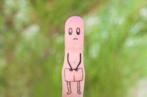 Balanite não costuma ser grave, mas provoca muitos desconfortos, e deve receber uma avaliação médica. Quer saber se balanite é transmissível, quais os sintomas, causas e tratamentos? Continue neste texto. O que é balanite? Essa patologia é uma inflamação da mucosa da glande (cabeça do pênis). Mas, o que causa balanite? Essa é uma condição que pode ser considerada comum, provocada por bactérias, fungos ou outros fatores. Geralmente, crianças menores de 4 anos e homens que não foram circuncidados estão mais sujeitos ao problema, especialmente por falta de higiene adequada da região, o que facilita que seja criado um ambiente propício para a proliferação de fungos e bactérias. Entre as principais causas da balanite estão a proliferação do fungo candida albicans nas camadas superficiais do pênis. Porém, outros fatores de risco podem favorecer o surgimento da balanite, como: diabetes não controlada, reação alérgica a produtos de higiene íntima, preservativos, medicamentos, doenças de pele (psoríase ou eczema), artrite reativa, lesões na glande ou prepúcio. A balanite não é contagiosa, portanto, não transmissível, mas pode sim ser uma consequência do contato direto com parceiros que têm alguma doença sexualmente transmissível, como a clamídia, sífilis ou herpes. Uma estimativa do Cleveland Clinic, um órgão de pesquisa acadêmica multiespecializado, revela que cerca de 10% dos homens poderão ter balanite ao longo da vida, por causas diversas. Complicações da balanite A balanite não tratada pode se transformar em uma condição crônica, que pode se complicar para outros quadros, como: Balanopostite Esse quadro pode estar associado também à inflamação do prepúcio, que é conhecida como postite. Quando ocorrem juntas, é chamado de balanopostite, que também inclui sintomas como irritação, coceira e inchaço da glande. Fimose A balanite a longo prazo pode provocar cicatrizes no pênis, que podem prejudicar a retração do prepúcio e a glande vai ficar escondida. Balanite xerótica obliterante Neste caso, a pele da glande endurece e fica esbranquiçada. Esse tecido endurecido pode dificultar a passagem do sêmen e urina pela uretra. Leia mais sobre: RTU de próstata Câncer de próstata Tipos de balanite Balanite Zoon Esse é o principal tipo de balanite, afeta homens não circuncidados que estão na faixa da meia-idade. Nestes casos, a glande fica inflamada e vermelha. Balanite circulante (balanite circinada) Essa é fruto da artrite reativa, que ocorre em resposta a uma infecção no corpo. Além de inflamação e coceira, provoca algumas lesões na cabeça do pênis. Balanite ceratótica Costuma afetar homens com mais de 60 anos, mas é um quadro muito raro, que provoca verrugas escamosas na cabeça do pênis. Balanite: sintomas Os principais sintomas podem se desenvolver gradualmente ou repentinamente, como: Pele da glande brilhante e bem firme; Dor e desconforto na glande; Aumento da sensibilidade do pênis; Inchaço; Vermelhidão e manchas na glande; Coceira; Secreção esbranquiçada (esmegma) sob o prepúcio; Cheiro fétido; Dor ao urinar; Feridas ou lesões (que são mais raras). Como curar balanite? Ao perceber esses sintomas, o primeiro passo que o homem deve dar para curar o problema é buscar um especialista para avaliar a condição. A patologia é tratável e pode ser diagnosticada a partir de uma consulta com um urologista, que vai realizar a anamnese para entender o histórico e realizar o exame físico, quando já pode constatar a glande vermelha e inchada. O médico também vai solicitar exames laboratoriais (sangue, urina e coleta de material uretral), que vai atestar se há uma infecção ou checar se são outras causas que estão provocando o quadro. Além disso, de acordo com a avaliação, o médico também pode sugerir que seja realizada uma biópsia, para descartar malignidade do quadro, pois a doença pode ser fruto de um câncer de pênis. Balanite: tratamento Como tratar balanite vai incluir uso de pomadas, antibióticos, melhor higiene pessoal e, em alguns casos, a circuncisão. Em geral, creme e pomada para balanite são indicadas quando o quadro foi causado por fungos. O medicamento deve ter aplicação tópica na glande e vai eliminar a quantidade de fungos na região. Já as pomadas corticoides são prescritas para reduzir a inflamação e os demais sintomas. Enquanto os antibióticos são prescritos quando a balanite foi causada por uma infecções por bactérias, como no caso de doenças sexualmente transmissíveis. Quando o homem tem diabetes, também é essencial tratar e controlar essa condição para evitar a balanite. No entanto, para alguns deles, especialmente aqueles que têm o prepúcio muito apertado, a circuncisão é a melhor forma de parar de sofrer com essa patologia. Higiene adequada é essencial para evitar o quadro Além do remédio para balanite, é importante que o homem pratique as formas adequadas de higiene íntima para não favorecer o surgimento do quadro, como: lavar o pênis todos os dias, puxando o prepúcio para trás para limpar a parte debaixo e secar bem, inclusive, também secar o mesmo local após urinar. Outro ponto importante, é que procure sempre usar preservativos nas relações sexuais, para evitar as DSTs, que também podem levar aos surgimento da balanite. Conclusão Se o homem tem os fatores de risco mencionados acima e os sintomas, não deve deixar a patologia evoluir para quadros mais complicados. O tratamento para balanite em fases iniciais é sempre mais fácil, assim como qualquer doença, a cura é mais rápida. Leia mais sobre: Câncer de bexiga